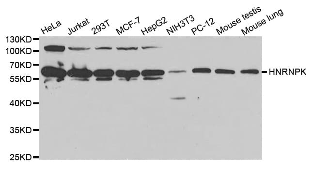 Polyclonal Rabbit anti-Human HNRNPK / hnRNP K Antibody (IHC, IF, WB)