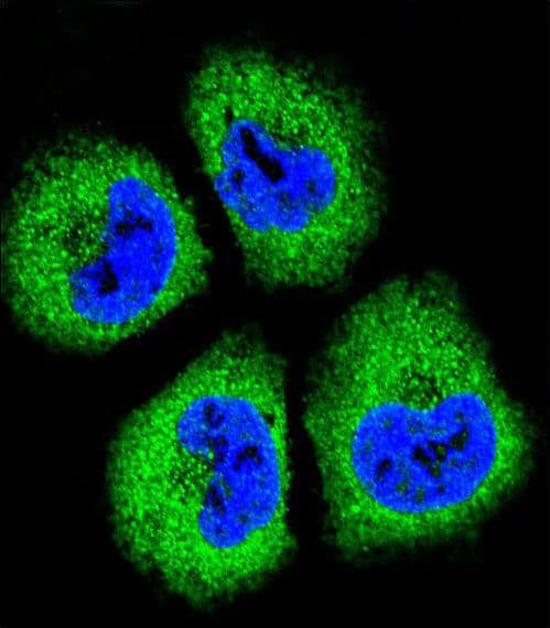 GAS1 Antibody (aa95-127)