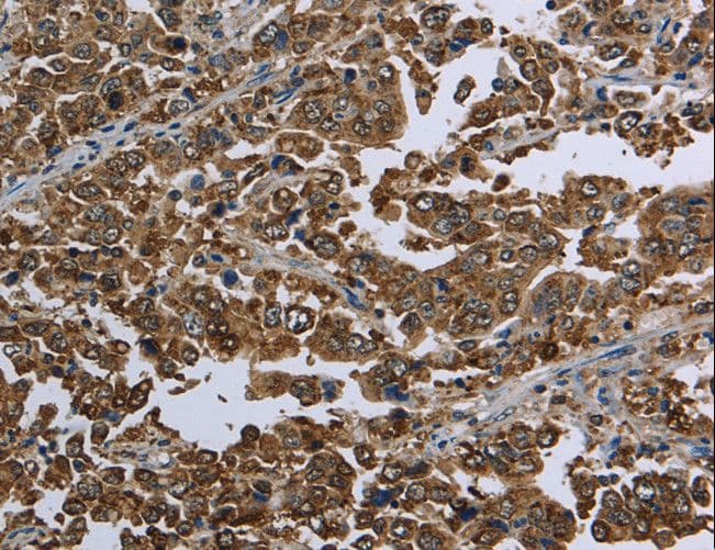 HSPA9 / Mortalin / GRP75 Antibody