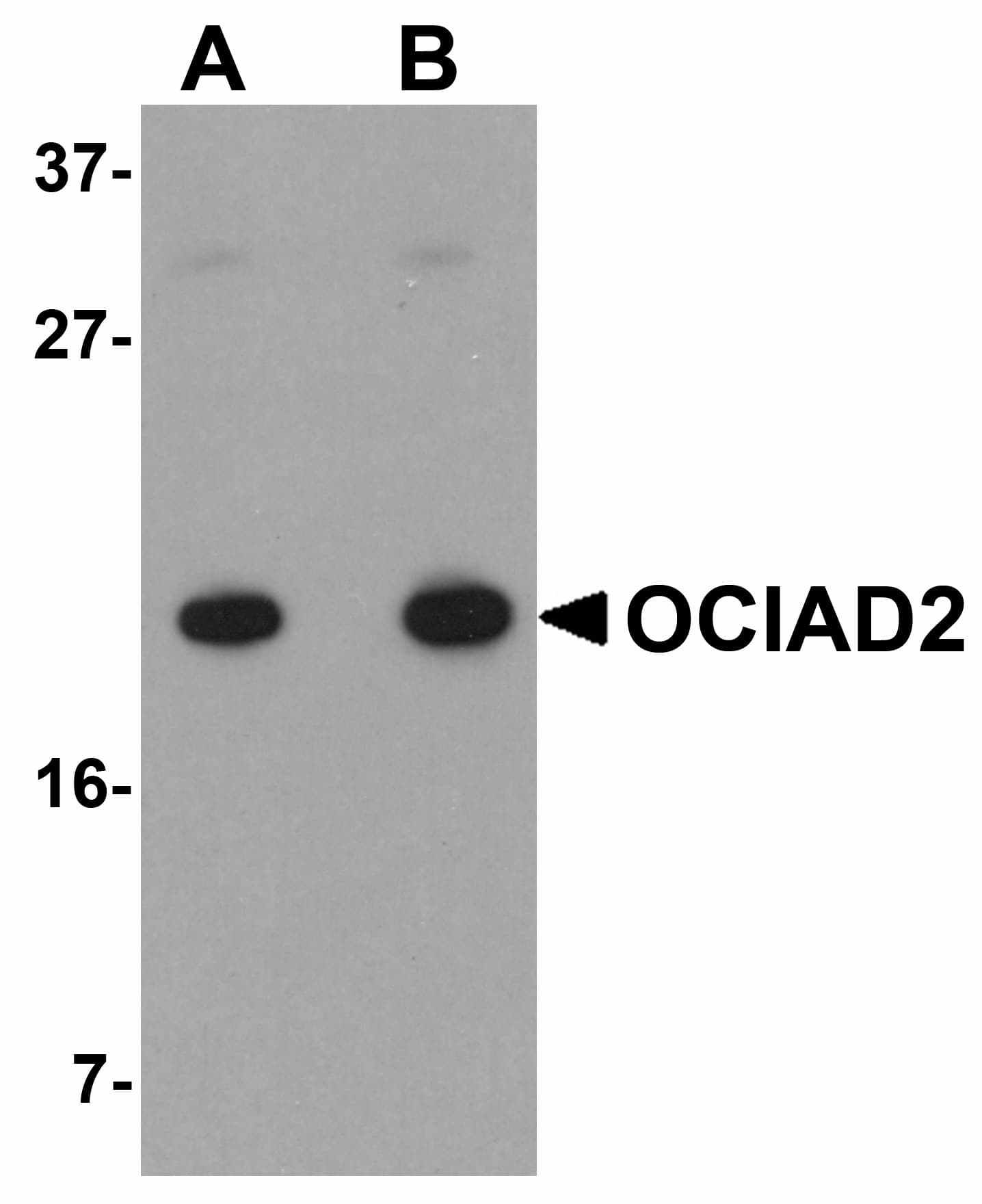 IHC-plus™ OCIAD2 Antibody