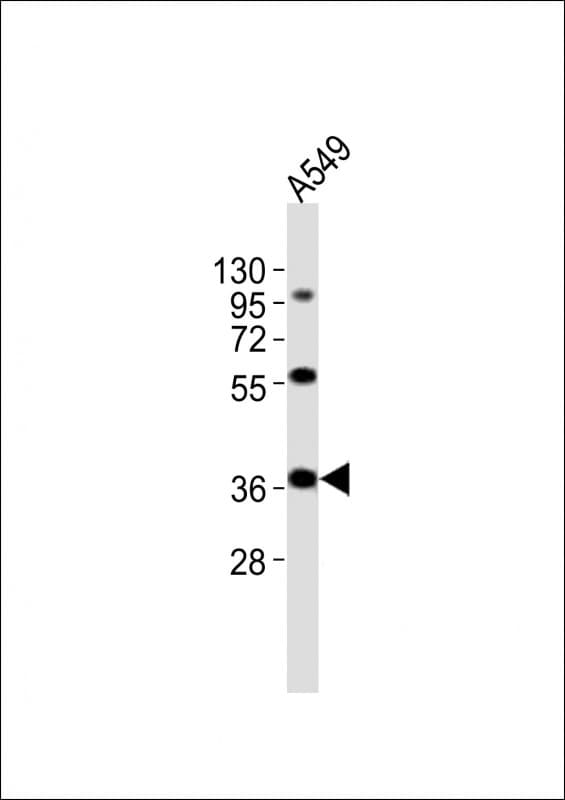 Polyclonal Rabbit anti-Human CTSL / Cathepsin L Antibody (aa97-129, WB)