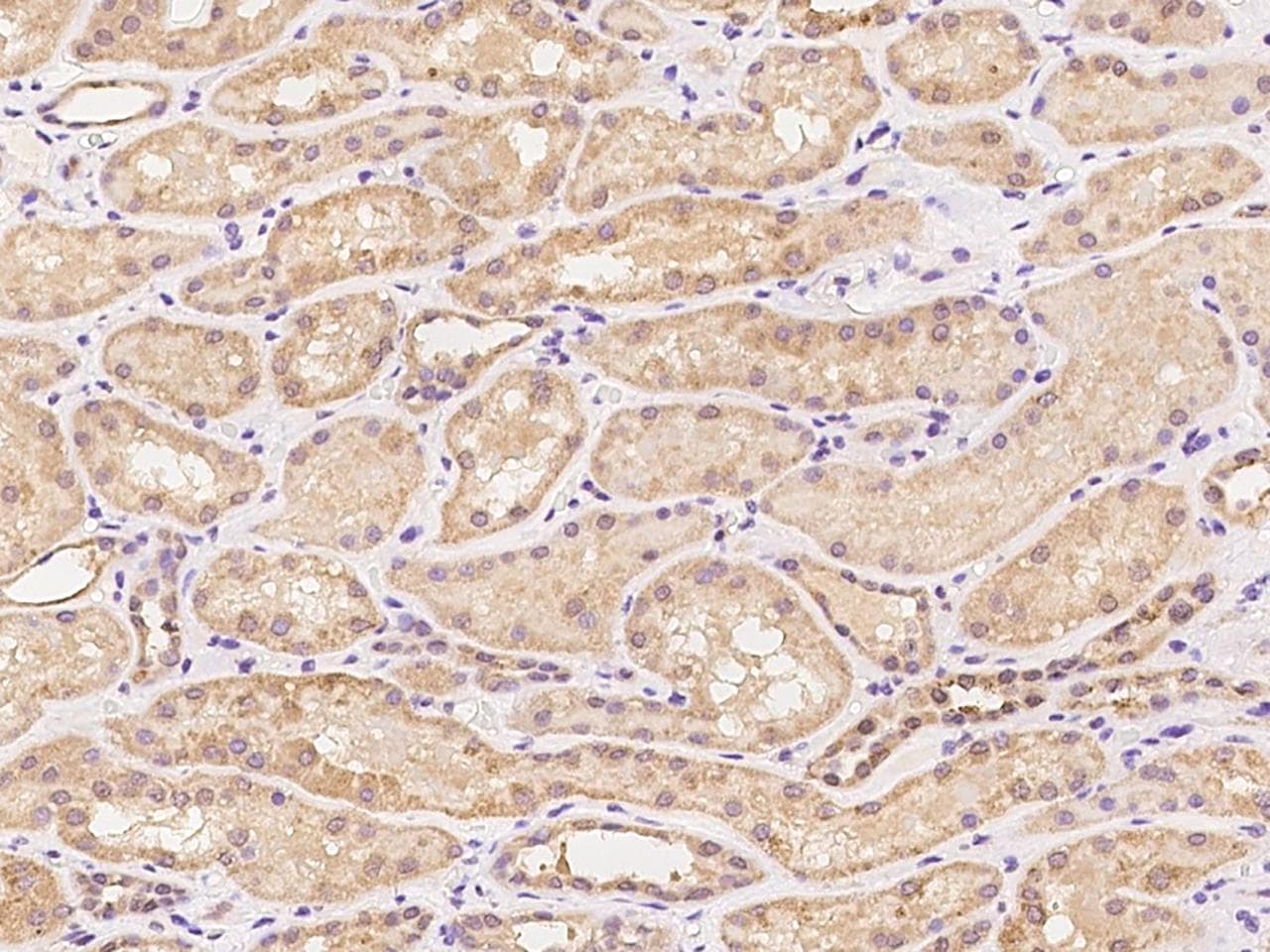 SYT17 Antibody