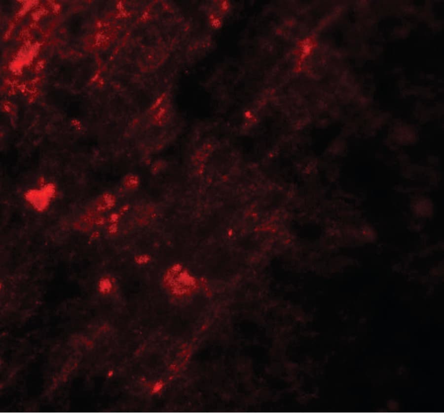 IHC-plus™ AIG1 Antibody
