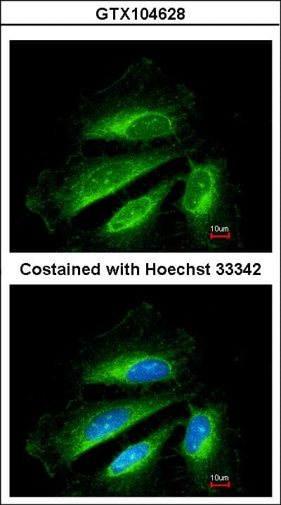 SDHB Antibody (aa221-280)