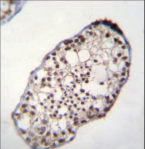 Polyclonal Rabbit anti-Human TSGA10IP Antibody (aa492-520, IHC, WB)