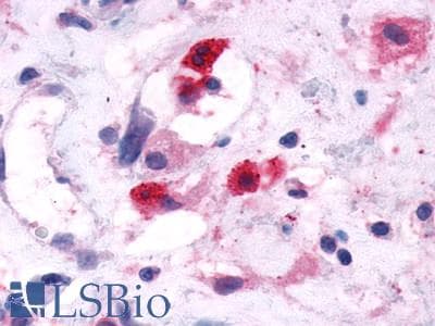 PathPlus™ GPR44 / CRTH2 Antibody (N-Terminus)