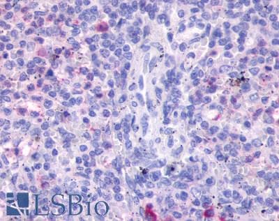 IHC-plus™ FPR3 / FPRL2 Antibody (Transmembrane Domain)