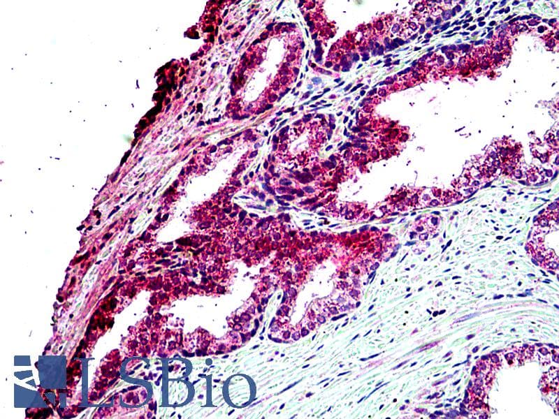 IHC-plus™ TBC1D10A Antibody (aa2-14)