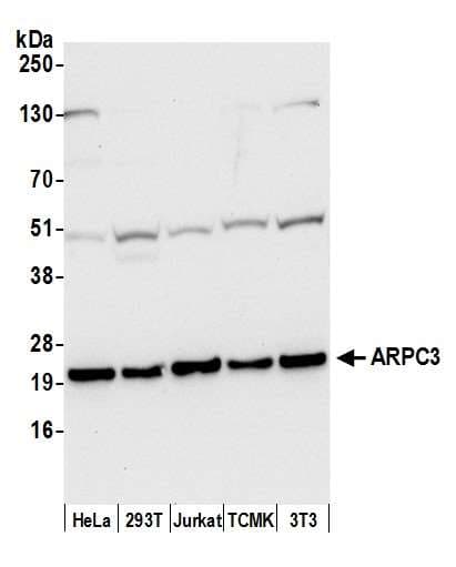 p21-ARC / ARPC3 Antibody (aa1-50)