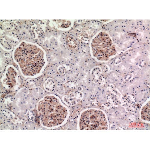 Polyclonal Rabbit anti-Human BST2 Antibody (101-150 aa, Internal, IHC, WB)