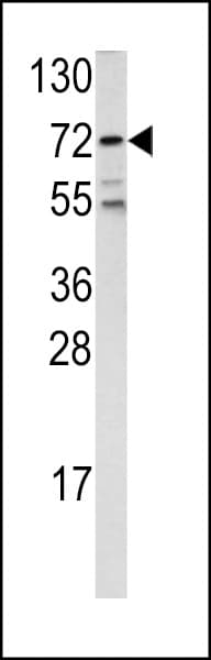 Polyclonal Rabbit anti-Human FOXO1 / FKHR Antibody (aa454-482, IHC, WB)