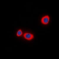 STMN1 / Stathmin / LAG Antibody (N-Terminus)