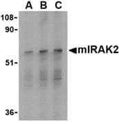IHC-plus™ IRAK2 / IRAK-2 Antibody
