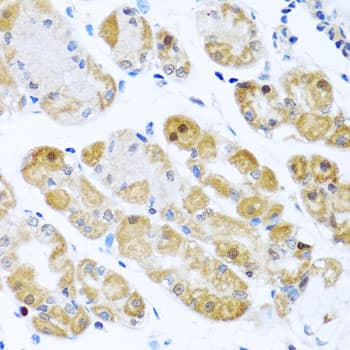 RPS2 / Ribosomal Protein S2 Antibody