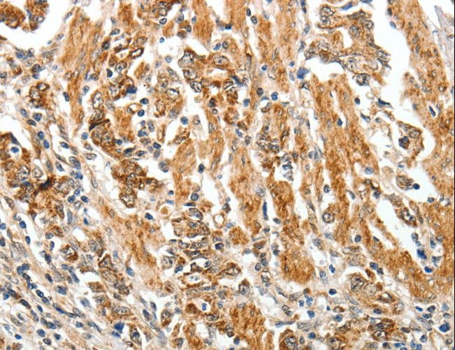 Polyclonal Rabbit anti-Human TGFBR1 / ALK5 Antibody (IHC)