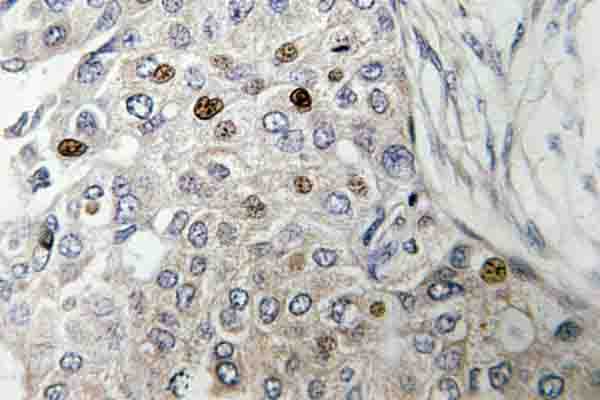 TP53 / p53 Antibody (Val31)