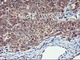 AGPAT5 Antibody (clone OTI1D12)