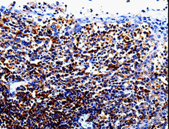IL10RA Antibody
