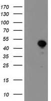 ALS2CR1 / NIF3L1 Antibody (clone OTI1F6)