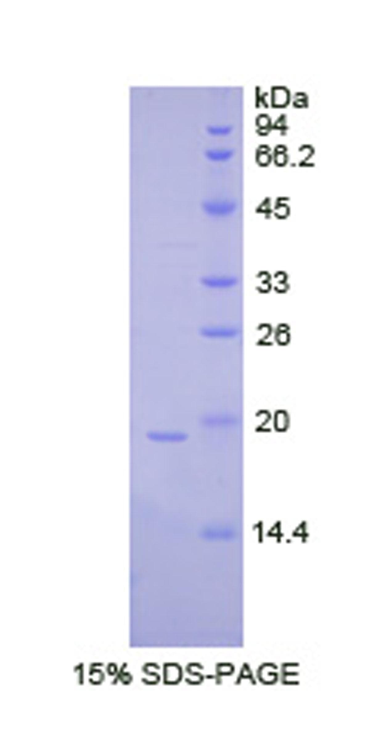 Human CSF3 / G-CSF Protein (Recombinant His)