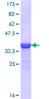 Human NARG1 / NAA15 Protein (Recombinant GST, N-terminus)