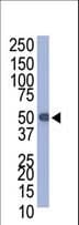 Polyclonal Rabbit PROC / Protein C Antibody (WB)