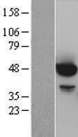 Human AKT1 Protein (Over-Expression Lysate Myc-DDK (Flag))
