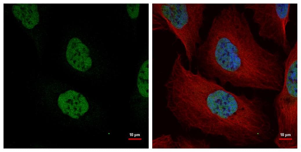 IHC-plus™ NUMA1 / NUMA Antibody (aa1-339)