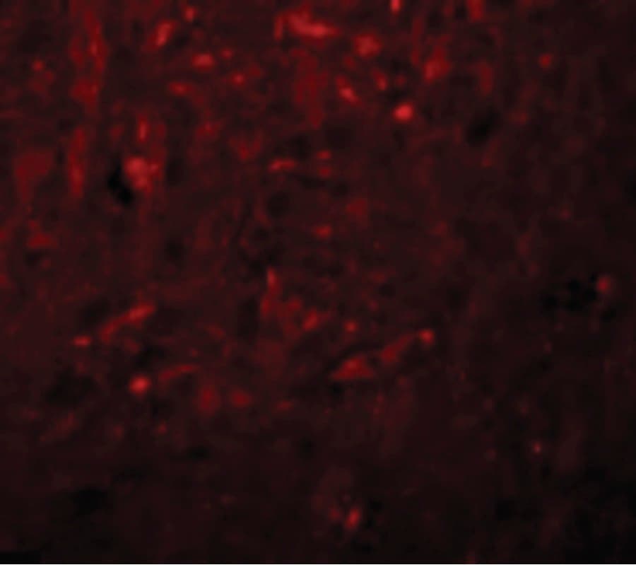 IHC-plus™ Polyclonal Rabbit anti-Human KCNK18 / TRESK Antibody (IHC, IF, WB)