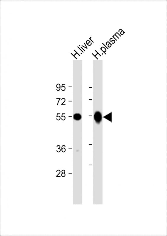 GC / Vitamin D-Binding Protein Antibody (C-Terminus)