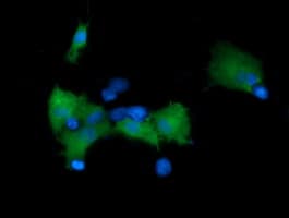 MAP2K1 / MKK1 / MEK1 Antibody (clone OTI7F3)