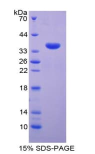 Human GDF10 / BMP3B Protein (Recombinant His-T7)