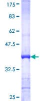 Human MYO7A / Myosin-VIIa Protein (Recombinant GST, N-terminus)