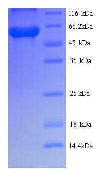 Rabies Virus gG Protein (Recombinant 6His, N-terminus)