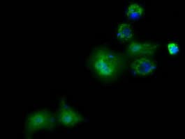 PANK2 Antibody (clone OTI3G4)