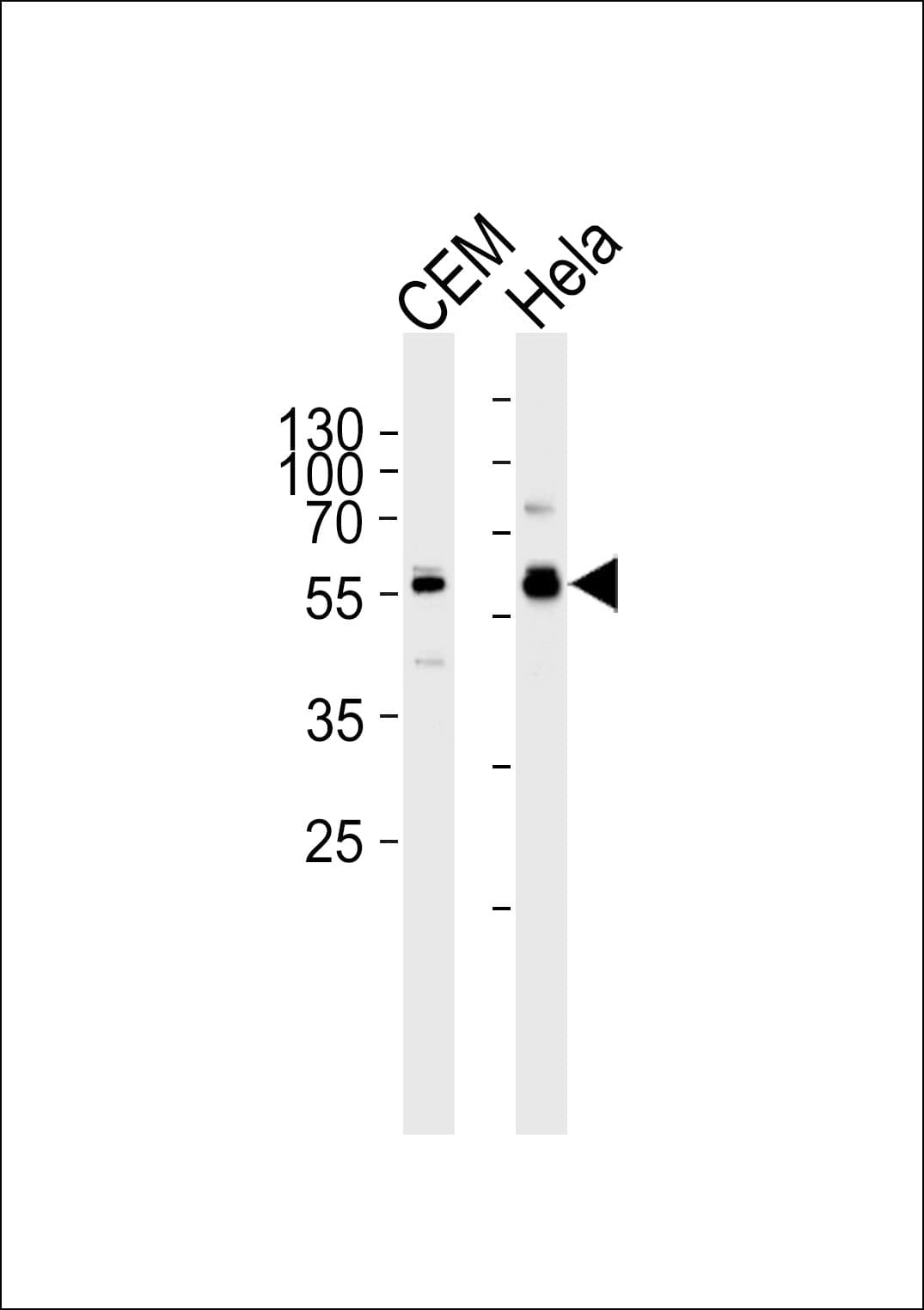 DYRK2 Antibody (aa105-135)