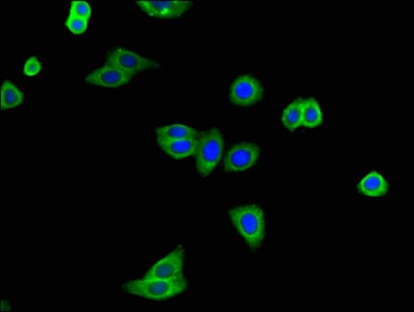 ATXN2 / SCA2 / Ataxin-2 Antibody