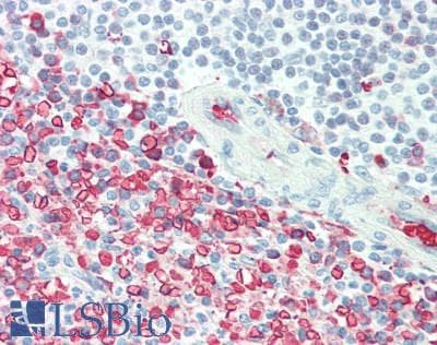 IHC-plus™ Polyclonal Rabbit anti-Human HAVCR2 / TIM-3 Antibody (IHC, IF, WB)