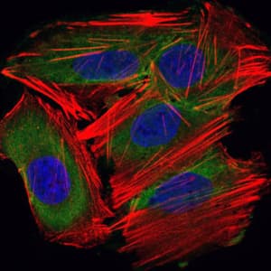 IHC-plus™ UBE2I / UBC9 Antibody (clone 1B10)