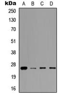 PRL / Prolactin Antibody (Internal)