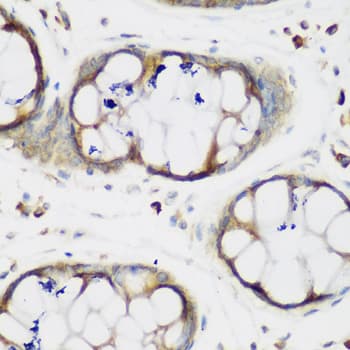 MTDH / Metadherin Antibody
