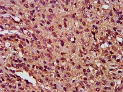 Polyclonal Rabbit anti-Human CFLAR / FLIP Antibody (IHC, WB)
