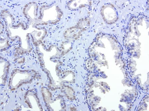 Monoclonal Mouse anti-Human HMBS / PBGD Antibody (clone UMAB144, Carrier-free, IHC, IF, WB)