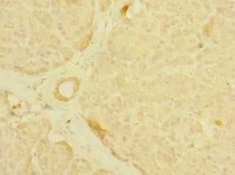 PALS2 / MPP6 Antibody