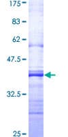 Human SIAH2 Protein (Recombinant GST, N-terminus)