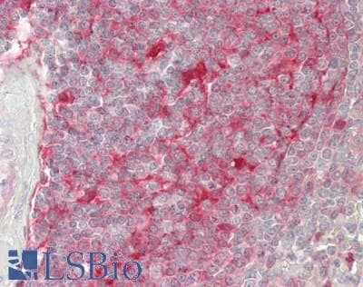 IHC-plus™ LGALS9 / Galectin 9 Antibody (clone 2A4)