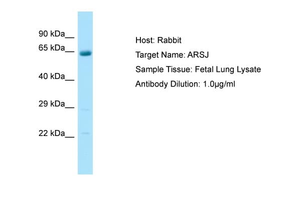 ARSJ / Arylsulfatase J Antibody (C-Terminus)