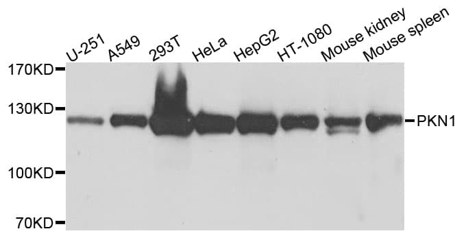 IHC-plus™ PKN1 Antibody