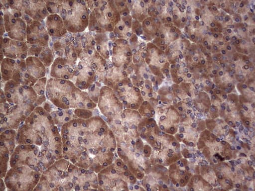 DICER1 / Dicer Antibody (aa1666-1922, clone OTI1G8)