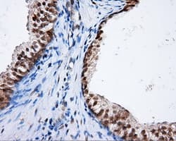 NPR3 Antibody (clone OTI11H5)
